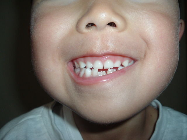 6歳パオの口 写真 トラ母日記 6歳パオの口 写真 トラ母日記