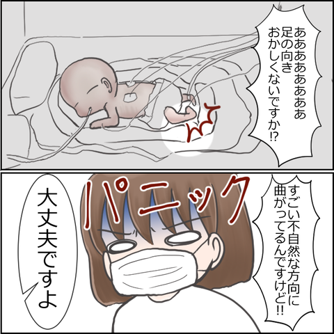 NICU4-6