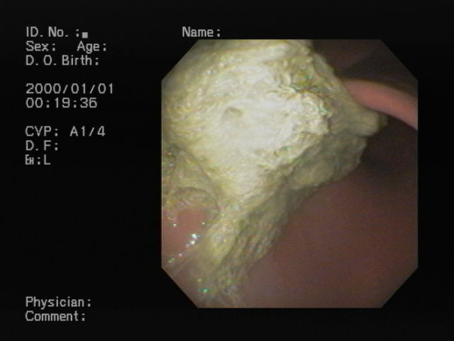 HPNX2640