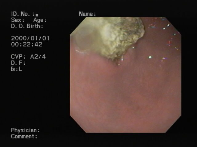 HPNX2647