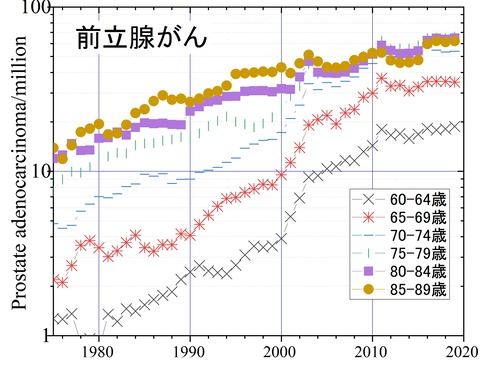 前立腺癌