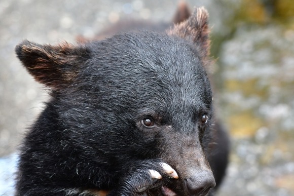 おっさん「クマに襲われ右目が飛び出している」