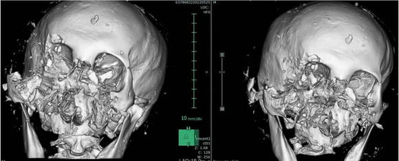 【画像】クマの軽いジャブはマイクタイソンの全力パンチの×10倍と思ってください
