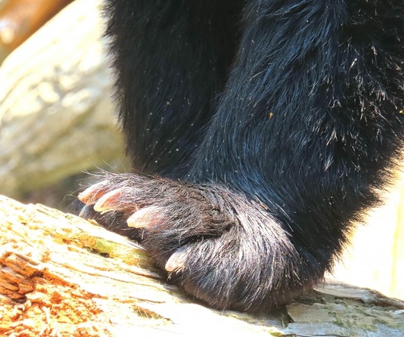 【悲報】女性さん、クマに目を潰される・・・・・・