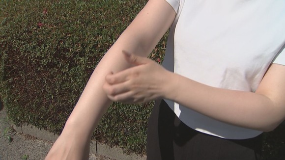 【蚊】「О型の人」「黒い服を着ている人」は刺されやすい?　ウソ?ホント?専門家に聞いた
