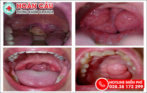 dau-co-hong-lau-ngay-khong-nen-chu-quan