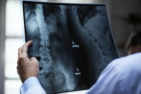 anatomy-3003099__340