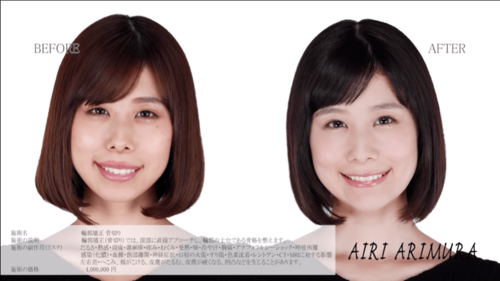 『有村藍里』有村架純の妹が口元整形を告白、近影が大反響