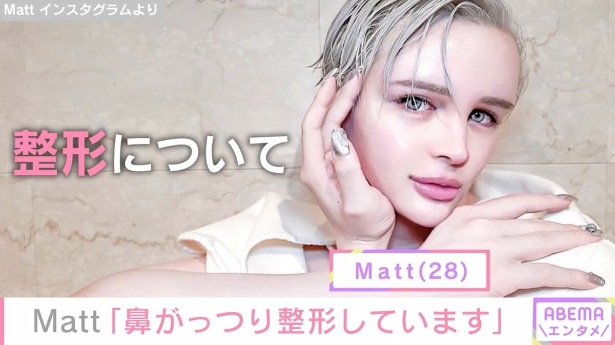 『Matt』ビックリ！鼻の整形を告白「自家肋軟骨使ってます」