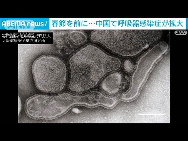 『ヒトメタニューモウイルス感染症』呼吸器感染症の一つ、中国で大流行！