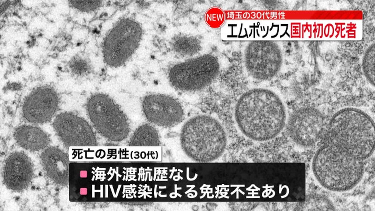 【防疫】怖いこわこわこわｗｗ「エムポックス」(サル痘)　国内初の死者を確認！