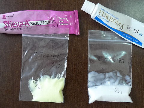 トレチノインによるいちご鼻の角栓や毛穴 凹凸の治療を開始 トレチノイン ハイドロキノンいちご鼻使用体験記