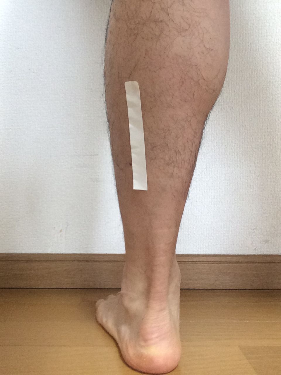 両ふくらはぎで肉離れもどき ハーフタイム後のボディ マネジメント 両ふくらはぎで肉離れもどき ハーフタイム後のボディ マネジメント