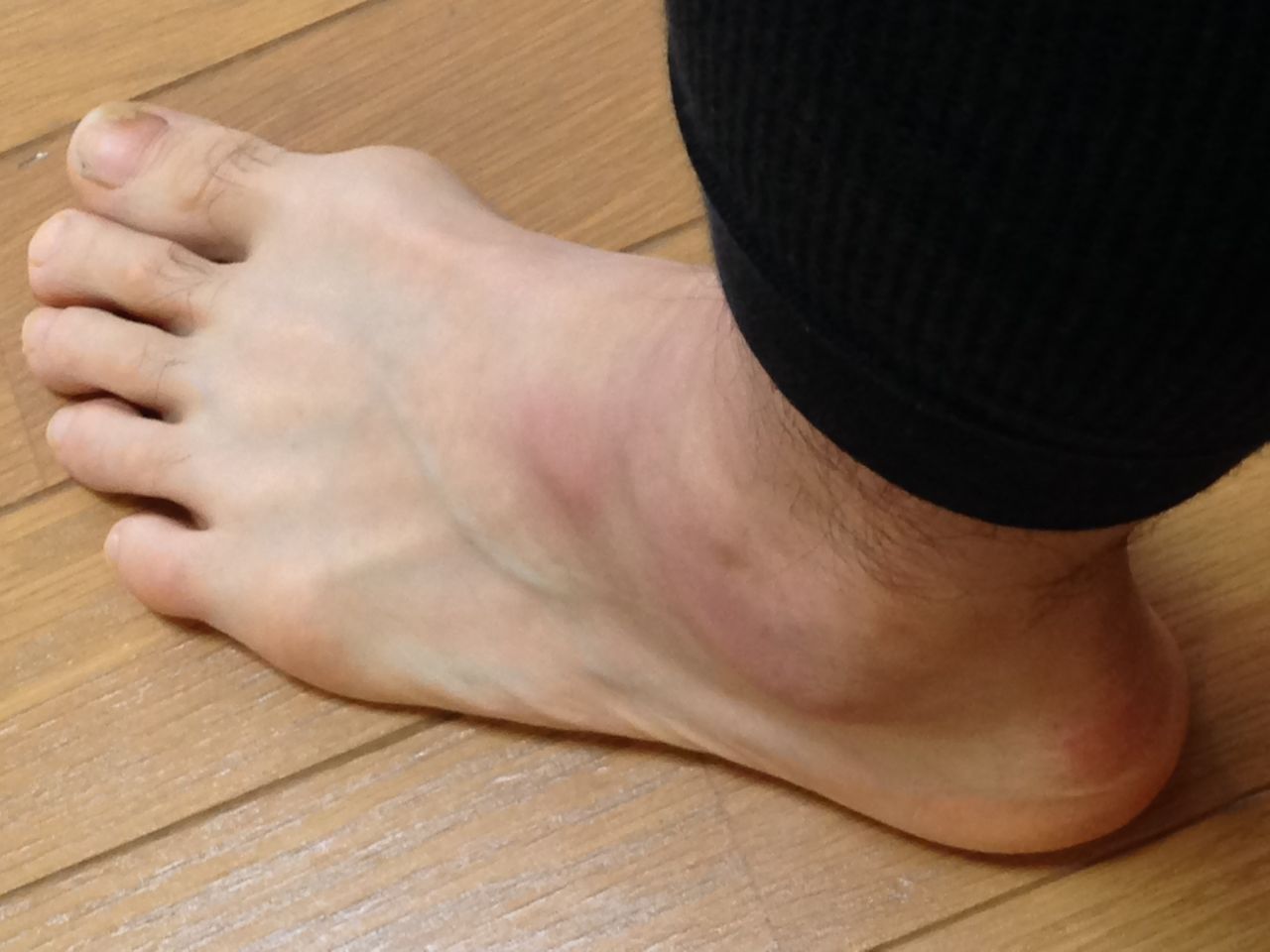 ハーフタイム後のボディ マネジメント ケガ