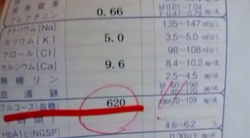 ニコ生の生主 健康診断の結果がガチでやば過ぎて医者から直接電話がくるｗｗｗｗｗｗｗｗｗｗｗｗ 妹 ｄｅｅｐ