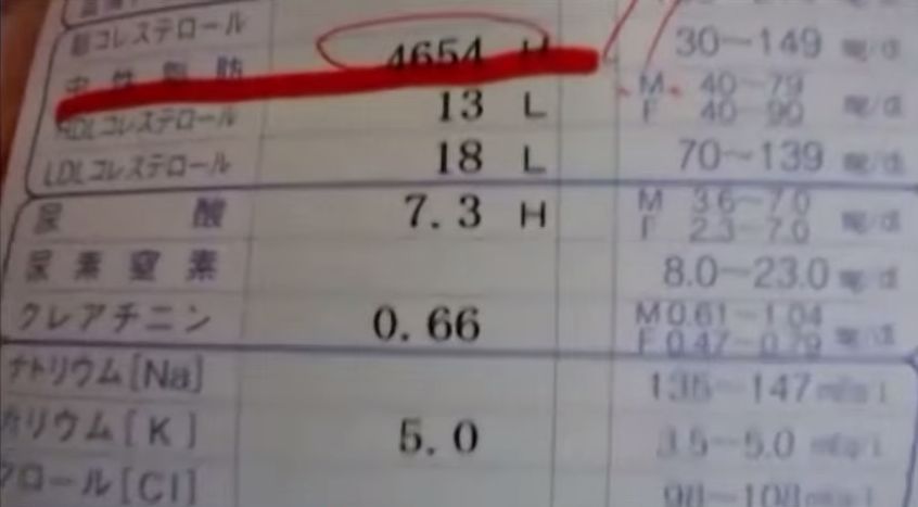 ニコ生の生主 健康診断の結果がガチでやば過ぎて医者から直接電話がくるwwwwwwwwwwww 妹 deep ニコ生の生主 健康診断の結果がガチでやば過ぎて医者から直接電話がくるwwwwwwwwwwww 妹 deep
