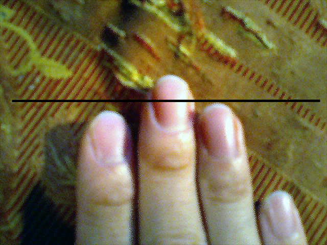 あなたはゲイですか診断 雪ガ恋人 君はトモダチ