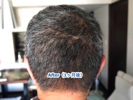 M1-4-after1x260