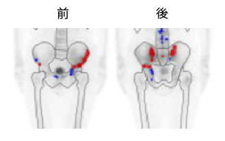 pelvis2