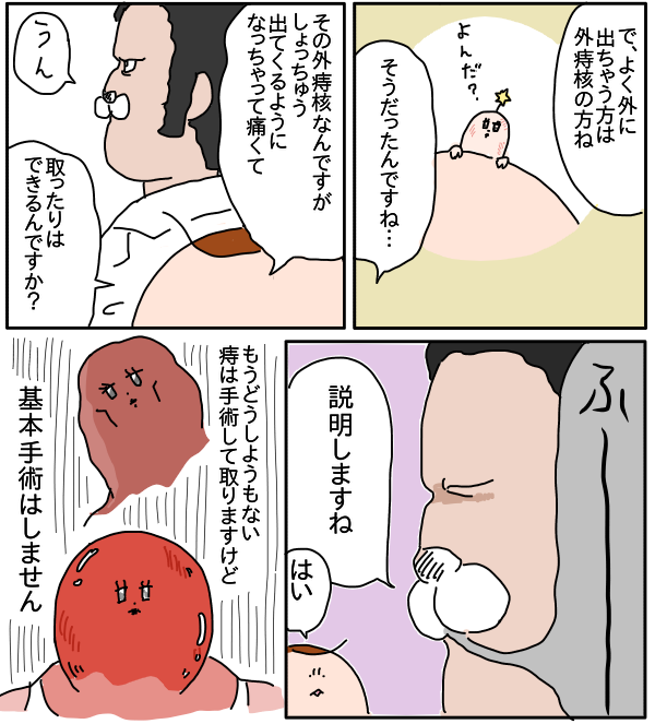 内診〜2種類のイボ痔〜 : つんの日常ブログ Powered by ライブドアブログ