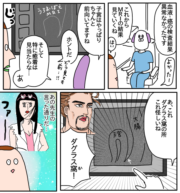 子宮内膜症の状態が知りたい 知れた つんの日常ブログ Powered By ライブドアブログ 子宮内膜症の状態が知りたい 知れた つんの日常ブログ Powered By ライブドアブログ