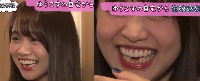 画像 ゆうこす 全国民に見つかるwwwwwwwwww ザ 芸能ニュース 画像 ゆうこす 全国民に見つかるwwwwwwwwww ザ 芸能ニュース