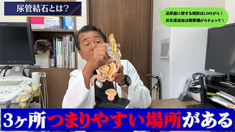 尿管結石やって人生観が変わった