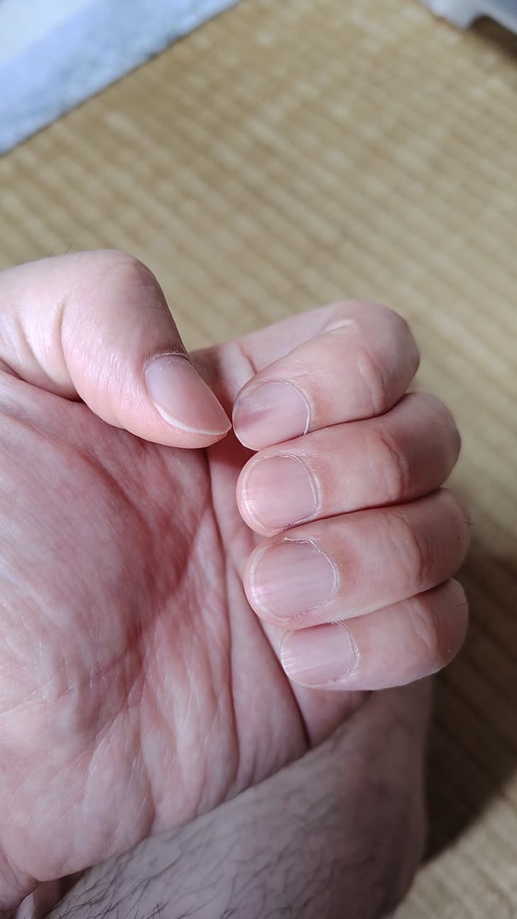 指