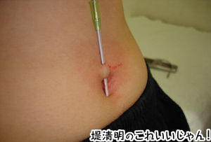 へそゴマをきれいに取る掃除セット へそゴマカラメトール 堤清明のこれいいじゃん