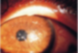 実話怪談 腐った眼の話 映像作家 鈴木ツヨシのぶらぶらブログ