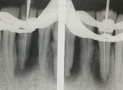 3451A735-A9B4-4A30-911D-D1B3A76F1018