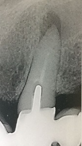 99CF9AEE-F655-44E5-9682-6DE683A02CF8