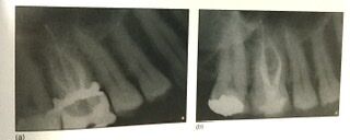 FECA31A2-CC1F-4AD7-8768-0FAB62454919