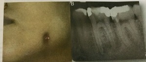 3DFCAE79-AFD1-49A9-B6E2-1EDF001446AE