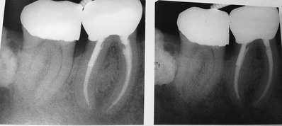 B247A91C-5FA9-493A-A502-54A0A99F9FAF