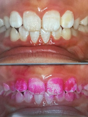 3E11223E-19F9-4AAE-8706-B1AD9F87F97B