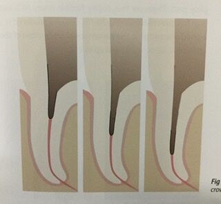 435023EE-2D46-495F-88A5-F935B28DD1BD