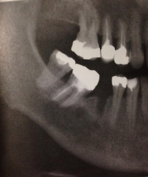 37075484_2226364690723294_2898579170718121984_n