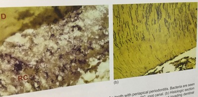 5DCA04CB-4BF9-4BA1-A2BB-5236A67683E5