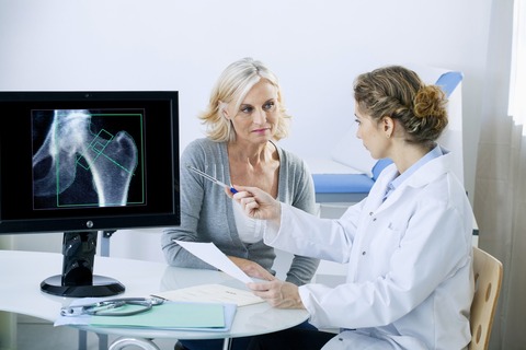 osteoporosis-woman