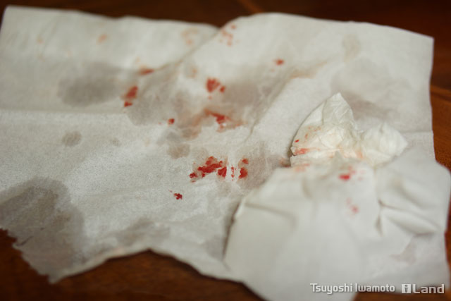 ヒゲを剃ると血が出る まとめ Tundieblog ヒゲを剃ると血が出る まとめ Tundieblog