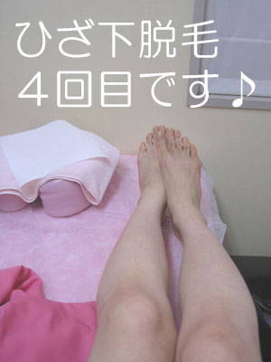 銀座カラーでひざ下脱毛4回目 写真あり 少しつるつるになってきたかな 銀座カラーでひざ下脱毛やってます