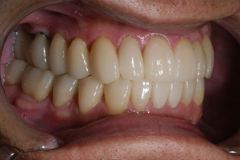 DSC04754