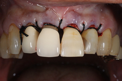 DSC08217 - コピー