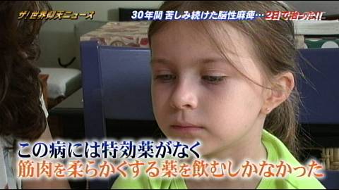 痙直型両麻痺とドーパ反応性ジストニア テレビっ子ひなのブログ 痙直型両麻痺とドーパ反応性ジストニア テレビっ子ひなのブログ