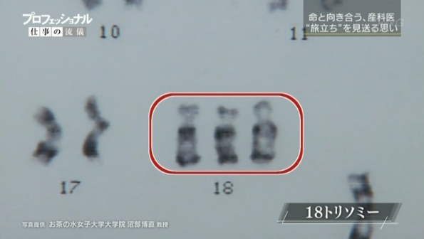 14 06 23 プロフェッショナル 産科医 川鮱市郎 テレビ感想部屋 14 06 23 プロフェッショナル 産科医 川鮱市郎 テレビ感想部屋