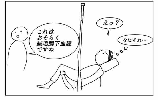 膜 血腫 絨毛 下