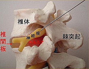 頸椎見本2