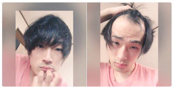 2chまとめ 歳ワイの頭頂部 ハゲてきて終わる 閲覧注意 フェニックス速報 2ch 5ch Twitterまとめブログ