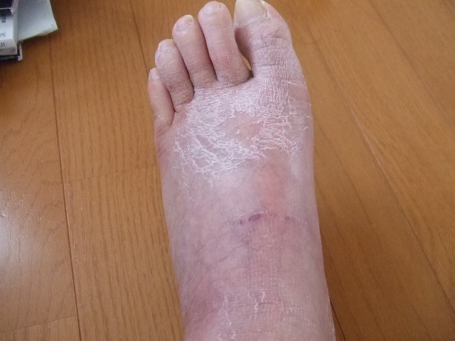 急変 気まぐれ者のblog